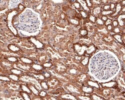 Invitrogen IL20RA Polyclonal Antibody 100 &mu;L; Unconjugated:Antibodies,
