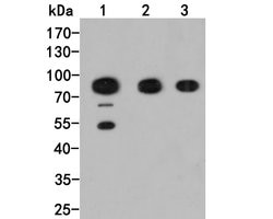 Invitrogen GABRB2 Polyclonal Antibody 100 &mu;L | Buy Online | Invitrogen&trade; | Fisher Scientific
