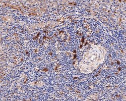 Invitrogen IL21R Polyclonal Antibody 100 &mu;L; Unconjugated:Antibodies,