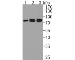 Invitrogen IL21R Polyclonal Antibody 100 &mu;L; Unconjugated:Antibodies,