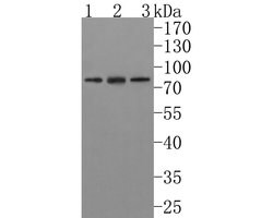 Invitrogen IL21R Polyclonal Antibody 100 &mu;L; Unconjugated:Antibodies,