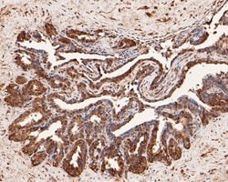 Invitrogen MYT1 Polyclonal Antibody 100 &mu;L; Unconjugated:Antibodies,