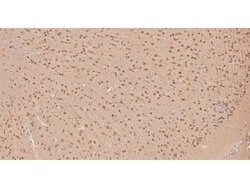 Invitrogen MYT1L Polyclonal Antibody 100 &mu;L; Unconjugated:Antibodies,