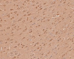 Invitrogen PLCB1 Polyclonal Antibody 100 &mu;L; Unconjugated:Antibodies,