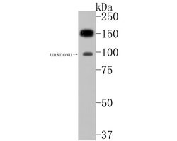 Invitrogen PLCB1 Polyclonal Antibody 100 &mu;L; Unconjugated:Antibodies,