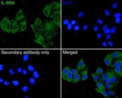 Invitrogen IL5RA Polyclonal Antibody 100 &mu;L; Unconjugated:Antibodies,
