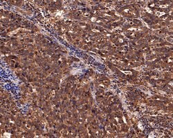 Invitrogen IL5RA Polyclonal Antibody 100 &mu;L; Unconjugated:Antibodies,