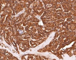 Invitrogen IL5RA Polyclonal Antibody 100 &mu;L; Unconjugated:Antibodies,