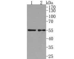 Invitrogen IL5RA Polyclonal Antibody 100 &mu;L; Unconjugated:Antibodies,