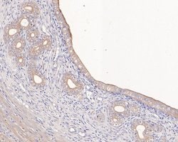Invitrogen AMHR2 Polyclonal Antibody 100 &mu;L; Unconjugated:Antibodies,