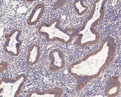 Invitrogen AMHR2 Polyclonal Antibody 100 &mu;L; Unconjugated:Antibodies,