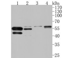 Invitrogen AMHR2 Polyclonal Antibody 100 &mu;L; Unconjugated:Antibodies,
