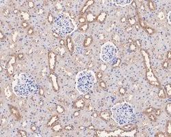 Invitrogen ARHGEF18 Polyclonal Antibody 100 &mu;L; Unconjugated:Antibodies,
