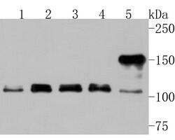 Invitrogen ARHGEF18 Polyclonal Antibody 100 &mu;L; Unconjugated:Antibodies,