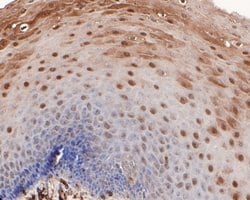 Invitrogen CLIC3 Polyclonal Antibody 100 &mu;L; Unconjugated:Antibodies,