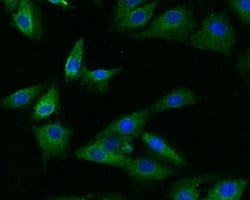 Invitrogen GRK3 Polyclonal Antibody 100 &mu;L | Buy Online | Invitrogen&trade; | Fisher Scientific