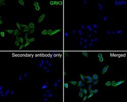 Invitrogen GRK3 Polyclonal Antibody 100 &mu;L | Buy Online | Invitrogen&trade; | Fisher Scientific