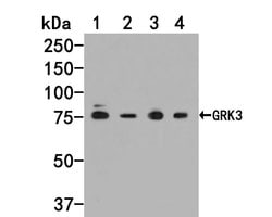 Invitrogen GRK3 Polyclonal Antibody 100 &mu;L | Buy Online | Invitrogen&trade; | Fisher Scientific