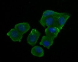 Invitrogen LRRTM1 Polyclonal Antibody 100 &mu;L; Unconjugated:Antibodies,