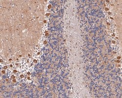 Invitrogen TRPM2 Polyclonal Antibody 100 &mu;L; Unconjugated:Antibodies,
