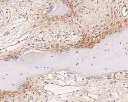 Invitrogen TRPM2 Polyclonal Antibody 100 &mu;L; Unconjugated:Antibodies,