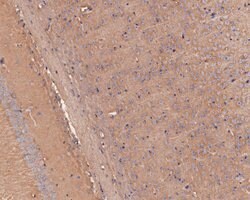 Invitrogen TRPM2 Polyclonal Antibody 100 &mu;L; Unconjugated:Antibodies,