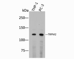 Invitrogen TRPM2 Polyclonal Antibody 100 &mu;L; Unconjugated:Antibodies,