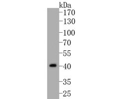 Invitrogen B3GAT1 Polyclonal Antibody 100 &mu;L | Buy Online | Invitrogen&trade; | Fisher Scientific