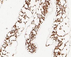 Invitrogen AP4E1 Polyclonal Antibody 100 &mu;L; Unconjugated:Antibodies,