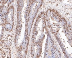 Invitrogen ONECUT3 Polyclonal Antibody 100 &mu;L; Unconjugated:Antibodies,