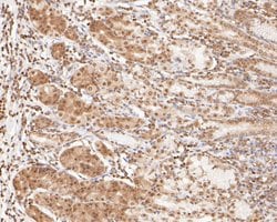 Invitrogen ONECUT3 Polyclonal Antibody 100 &mu;L; Unconjugated:Antibodies,