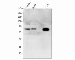 Invitrogen ONECUT3 Polyclonal Antibody 100 &mu;L; Unconjugated:Antibodies,