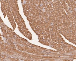 Invitrogen&trade;&nbsp;MYL4 Polyclonal Antibody