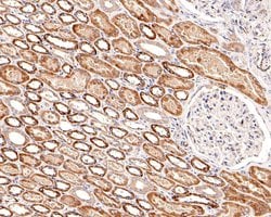 Invitrogen P-Glycoprotein Polyclonal Antibody 100 &mu;L; Unconjugated:Antibodies,