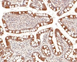 Invitrogen P-Glycoprotein Polyclonal Antibody 100 &mu;L; Unconjugated:Antibodies,