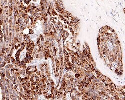 Invitrogen P-Glycoprotein Polyclonal Antibody 100 &mu;L; Unconjugated:Antibodies,