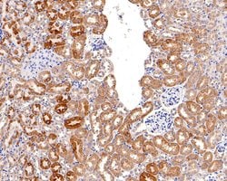 Invitrogen P-Glycoprotein Polyclonal Antibody 100 &mu;L; Unconjugated:Antibodies,