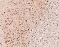 Invitrogen P-Glycoprotein Polyclonal Antibody 100 &mu;L; Unconjugated:Antibodies,
