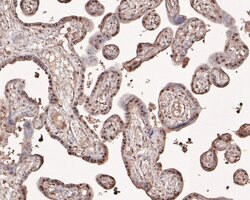 Invitrogen PHF11 Polyclonal Antibody 100 &mu;L; Unconjugated:Antibodies,
