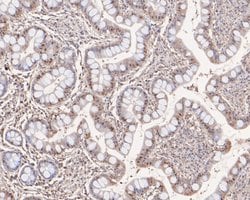 Invitrogen PHF11 Polyclonal Antibody 100 &mu;L; Unconjugated:Antibodies,