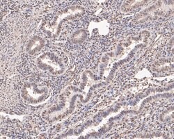 Invitrogen PHF11 Polyclonal Antibody 100 &mu;L; Unconjugated:Antibodies,