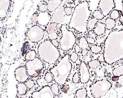Invitrogen RAD52 Polyclonal Antibody 100 &mu;L; Unconjugated:Antibodies,