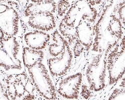 Invitrogen RAD52 Polyclonal Antibody 100 &mu;L; Unconjugated:Antibodies,
