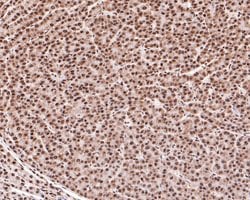 Invitrogen RAD52 Polyclonal Antibody 100 &mu;L; Unconjugated:Antibodies,