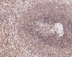 Invitrogen RAD52 Polyclonal Antibody 100 &mu;L; Unconjugated:Antibodies,