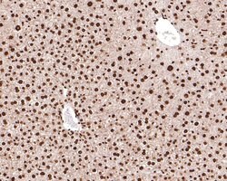 Invitrogen RAD52 Polyclonal Antibody 100 &mu;L; Unconjugated:Antibodies,
