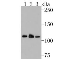 Invitrogen RNF111 Polyclonal Antibody 100 &mu;L | Buy Online | Invitrogen&trade; | Fisher Scientific