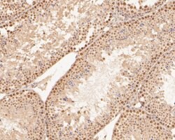 Invitrogen CDX4 Polyclonal Antibody 100 &mu;L; Unconjugated:Antibodies,