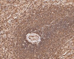 Invitrogen WASP Polyclonal Antibody 100 μL; Unconjugated:Antibodies,