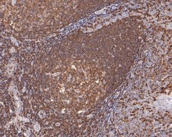 Invitrogen WASP Polyclonal Antibody 100 μL; Unconjugated:Antibodies,